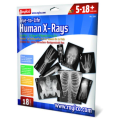True To Life Human X-Rays